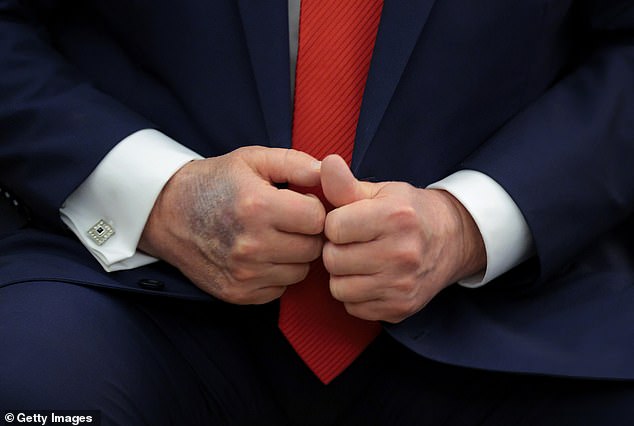 Eric Trump Confronts Health Rumors as Public Concerns Over President's Well-Being Intensify