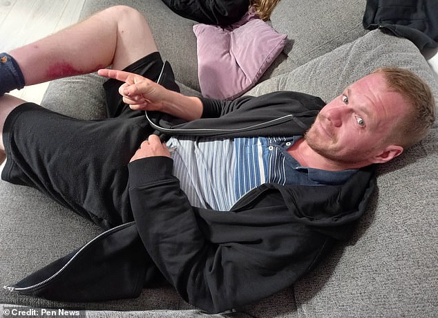 A Medical Anomaly and the Hidden Peril of Britain’s Most Dangerous Spider