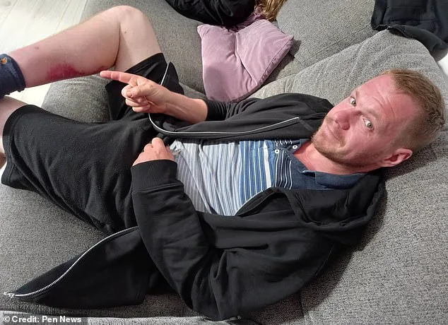 A Medical Anomaly and the Hidden Peril of Britain’s Most Dangerous Spider