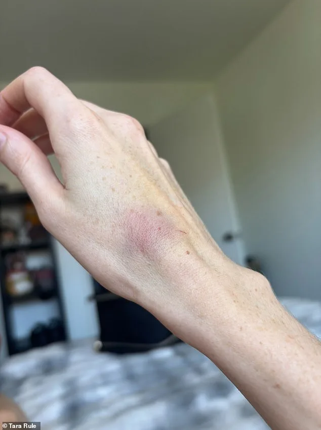 Late-Breaking: TikTok Influencer with Ehlers-Danlos Syndrome Demands Urgent Action After American Airlines Refuses Accommodations