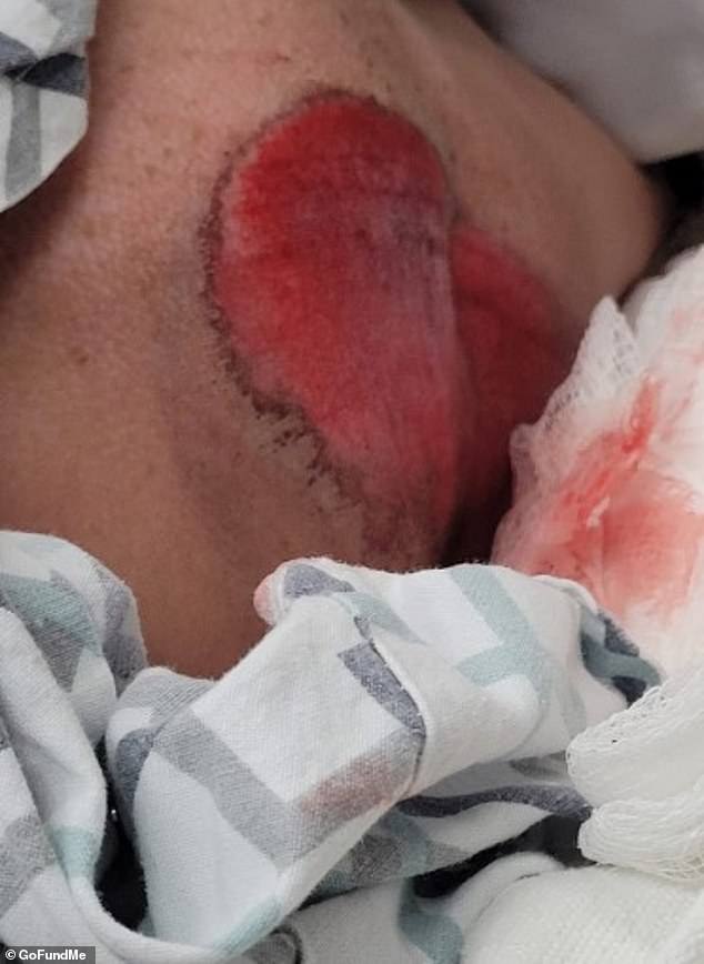 Kaukauna Tragedy Sparks Debate Over Scooter Safety Laws for Youth