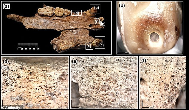 Roman Amphitheatre Fossil Evidence Uncovers Bear's Fatal Injury, Revealing Ancient Combat Risks