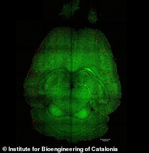 Breakthrough in Alzheimer's Research: Nanoparticles Reverse Disease in Mice, Sparking Hope for Human Treatment