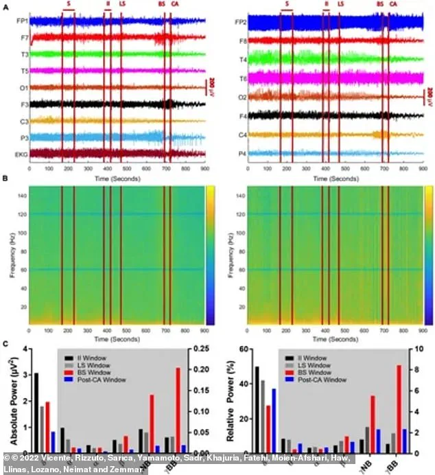 New Study Suggests Dying Brain Relives Life Memories, Challenging Previous Beliefs
