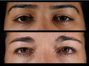 Chinese Study Sparks Global Debate on Meat Consumption and Health Benefits