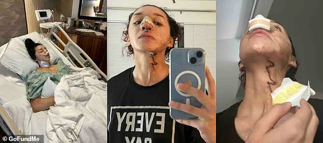 Breaking: Davina Licon's Acid Attack Survival Battle Intensifies After Five Surgeries