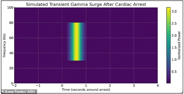 Groundbreaking Study Challenges Traditional Death Definition, Suggesting Consciousness May Persist Beyond Heart Stop