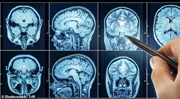 Global Outrage as Declassified CIA Documents Reveal Six-Decade Cover-Up Behind Potential Cancer Treatment Patent