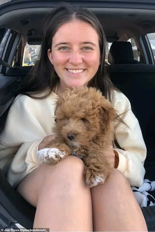 Dancer's Tumor: A Rare Find Under 25