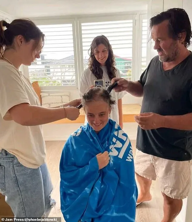 Dancer's Tumor: A Rare Find Under 25