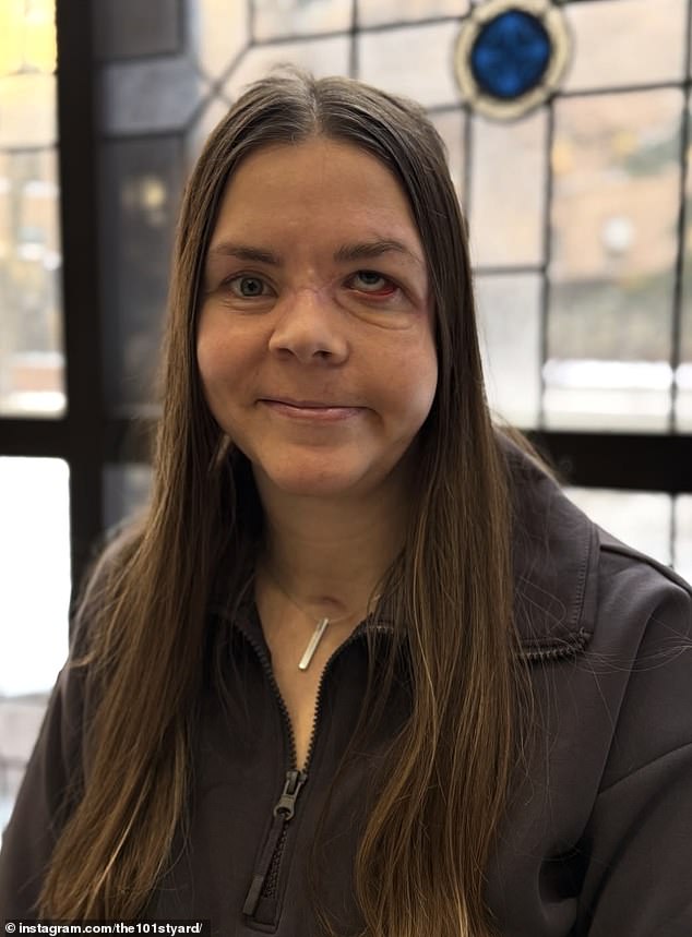 Kenai Mother Survives Bear Attack With Severe Spine And Hip Damage