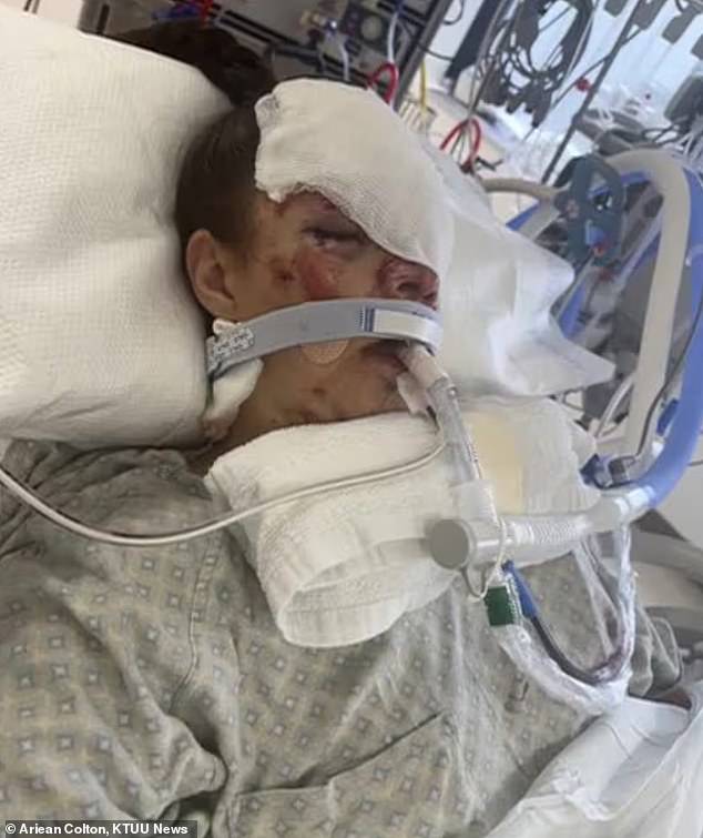 Kenai Mother Survives Bear Attack With Severe Spine And Hip Damage