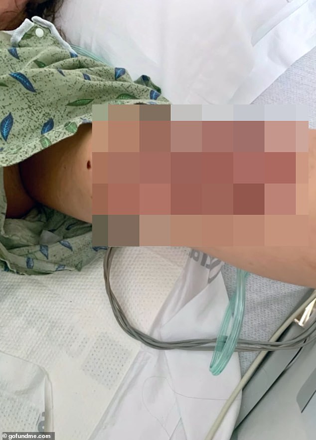Star Button's routine hysterectomy turned into a life-altering medical nightmare.