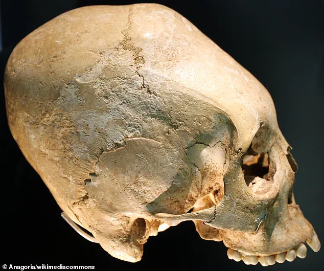 Unearthed Skull in Argentina Sparks Scientific Controversy Over Its Origins