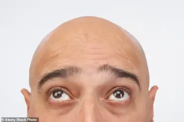 Japanese Researchers Edge Closer to Hair Loss Solution, but Challenges Remain
