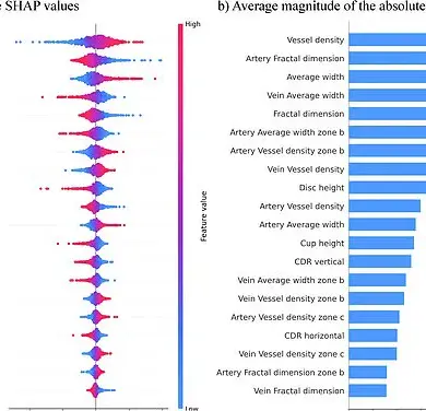 South Korean Scientists Identify Potential Eye Biomarker for ADHD