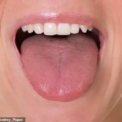The Tongue as a Window to Health: Expert Insights on Detecting Systemic Conditions Through Oral Indicators