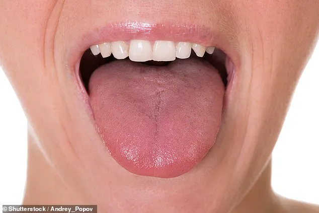 The Tongue as a Window to Health: Expert Insights on Detecting Systemic Conditions Through Oral Indicators