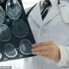 Brain Structure Differences in Psychopaths May Explain Emotional and Behavioral Risks to Communities