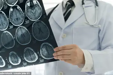 Brain Structure Differences in Psychopaths May Explain Emotional and Behavioral Risks to Communities