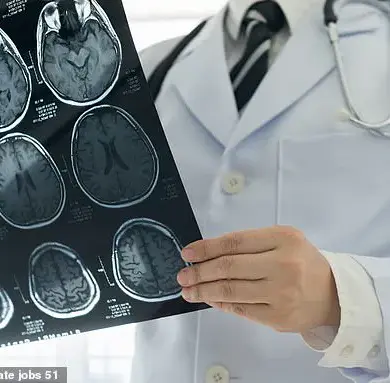 Brain Structure Differences in Psychopaths May Explain Emotional and Behavioral Risks to Communities