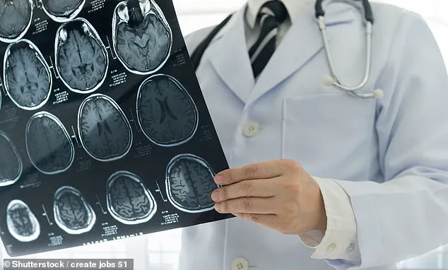 Brain Structure Differences in Psychopaths May Explain Emotional and Behavioral Risks to Communities