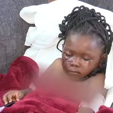 BREAKING: Five-Year-Old Girl in Indiana Survives Brutal Pit Bull Attack, Left Permanently Scarred