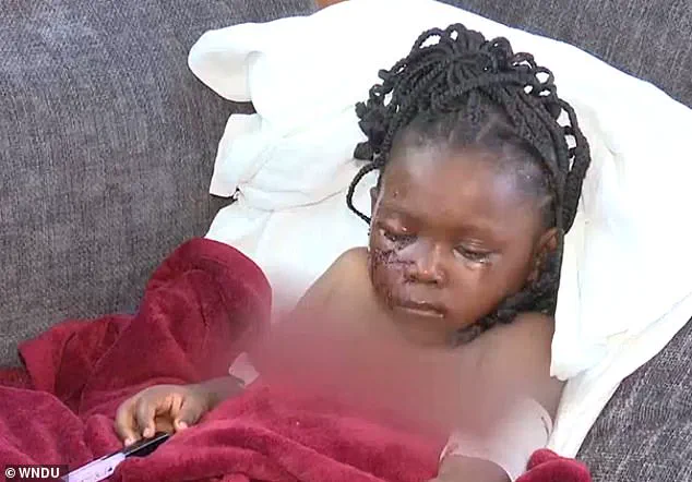 BREAKING: Five-Year-Old Girl in Indiana Survives Brutal Pit Bull Attack, Left Permanently Scarred