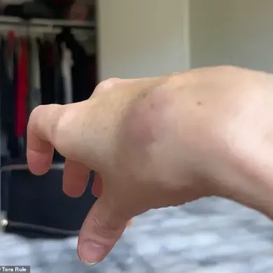 Late-Breaking: TikTok Influencer with Ehlers-Danlos Syndrome Demands Urgent Action After American Airlines Refuses Accommodations