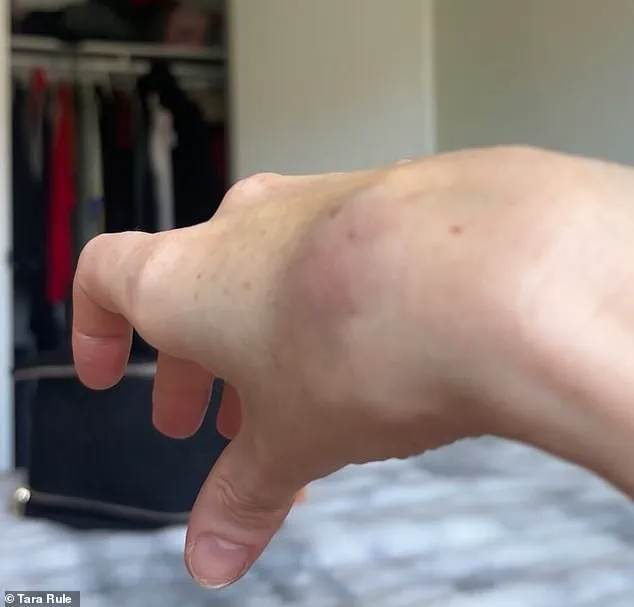Late-Breaking: TikTok Influencer with Ehlers-Danlos Syndrome Demands Urgent Action After American Airlines Refuses Accommodations